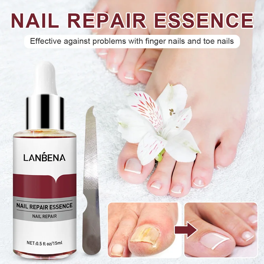 LANBENA Toenail Repair Essence для ногтей лечение грибка сыворотка онихомикоз трещины