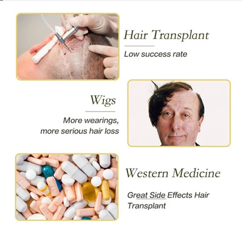 Новинка 2021 сыворотка для быстрого роста волос 20 мл жидкость предотвращения