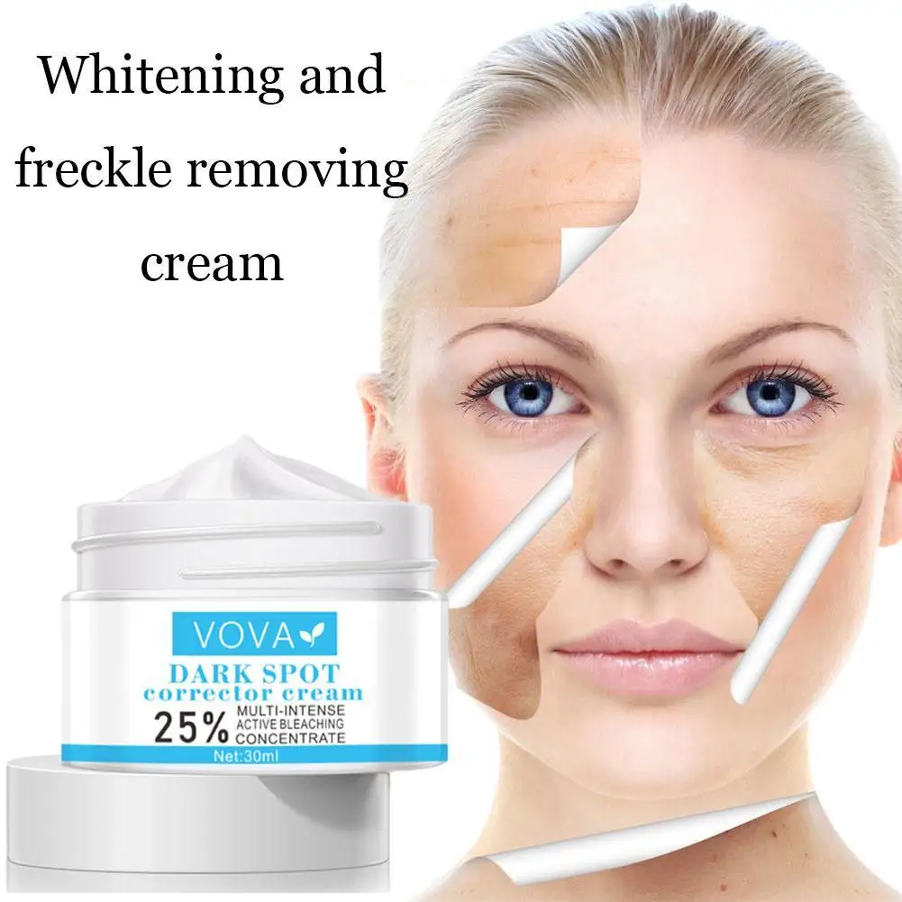 

Effective Whitening Freckle Cream Remove Melasma Acne Spot Dark Dark Spot Melanin Pigment Pigmentation Cream Corrector Spot P6A2