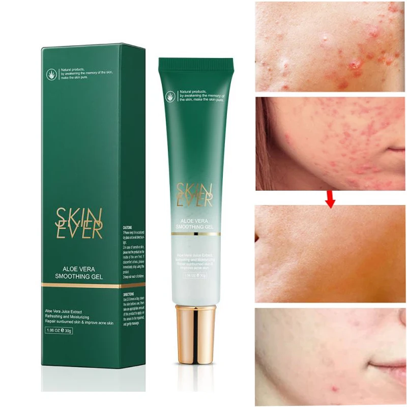 

Aloe Moisturizing Smoothing Face Gel Oil Control Acne Removal Shrink Pore Brighten Whiten Lift Tighten Cream Repair After Sun