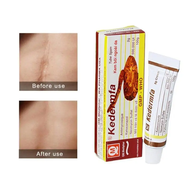 5g оригинальный змея нанесенном вручную масляной крем уход за кожей питательный