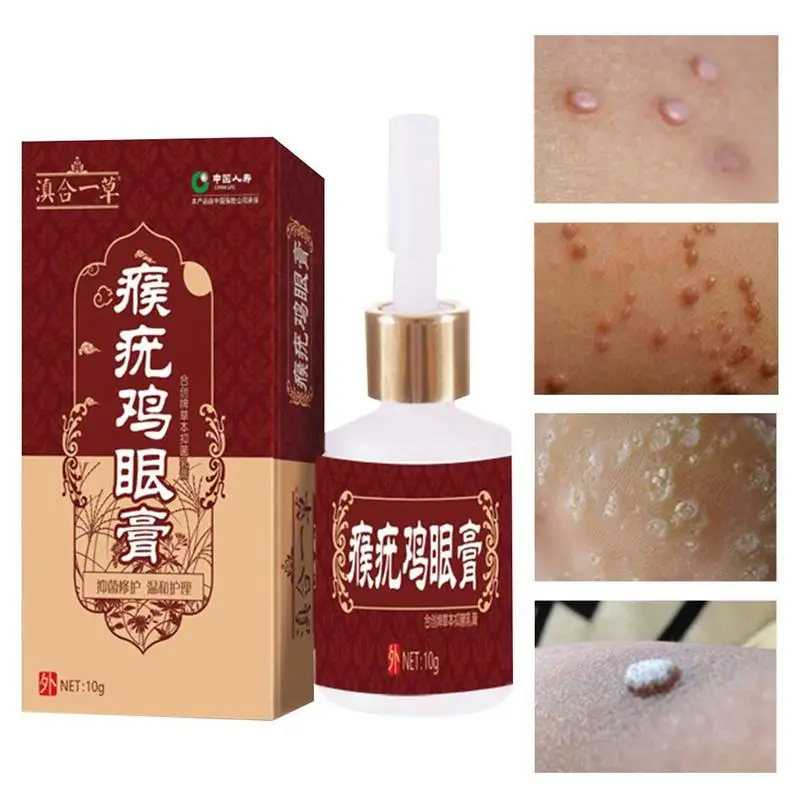 

10ml Skin Tag Remover Tu Kill Medical Tu Kill Remover Wart Foot Tag Remover Genital Liquid Remover Blackhead Skin Mole Corn C2K0