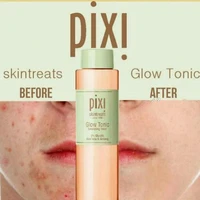 pixi 5 glycolic acid moisturizing oil control skin lift anti acne essence toner tonic makeup suitable for oily skin care serum