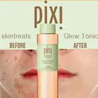 Тоник Pixi с 5% гликолевой кислотой, увлажняющий, контролирующий жирность, для подтяжки кожи, тоник, тоник для макияжа, подходит для ухода за жирной кожей
