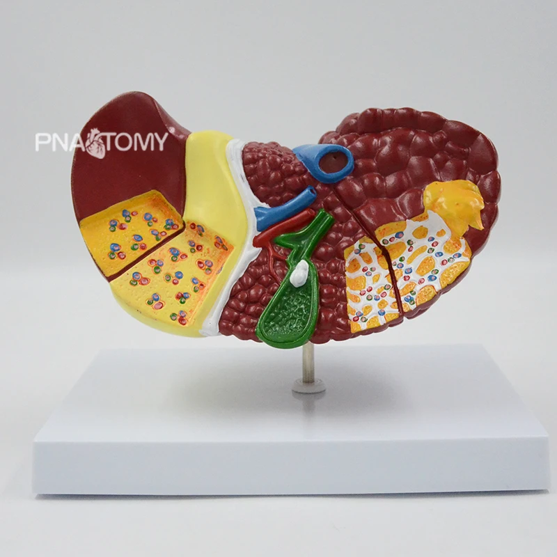 Liver with Pathologies Diseased Liver Model Human Anatomical Model Medical Gift Teaching Resources Educational Equipment