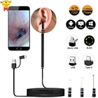 Медицинская ложка-эндоскоп для чистки ушей, мини-камера для извлечения ушей и воска, отоскоп с визуальным изображением уха, рта, носа, с поддержкой Android и ПК