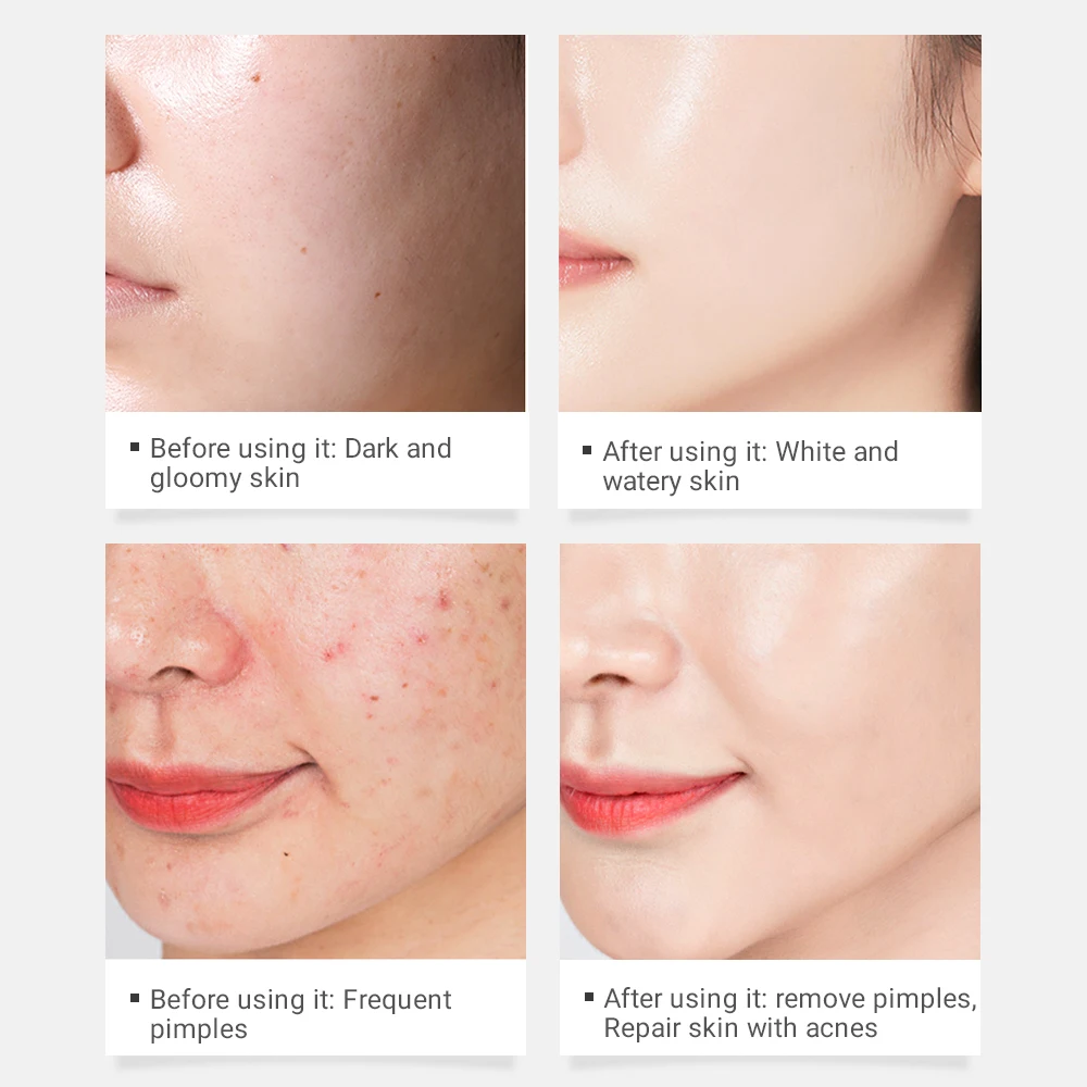 Крем для лица BAIMISS увлажняющая и укрепляющая кожу отшелушивающая маска против