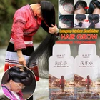 Рисовый шампунь для роста волос против выпадения волос, Мужская Сыворотка для быстрого роста, более густые волосы для мужчин и женщин, лучший продукт для ухода за волосами