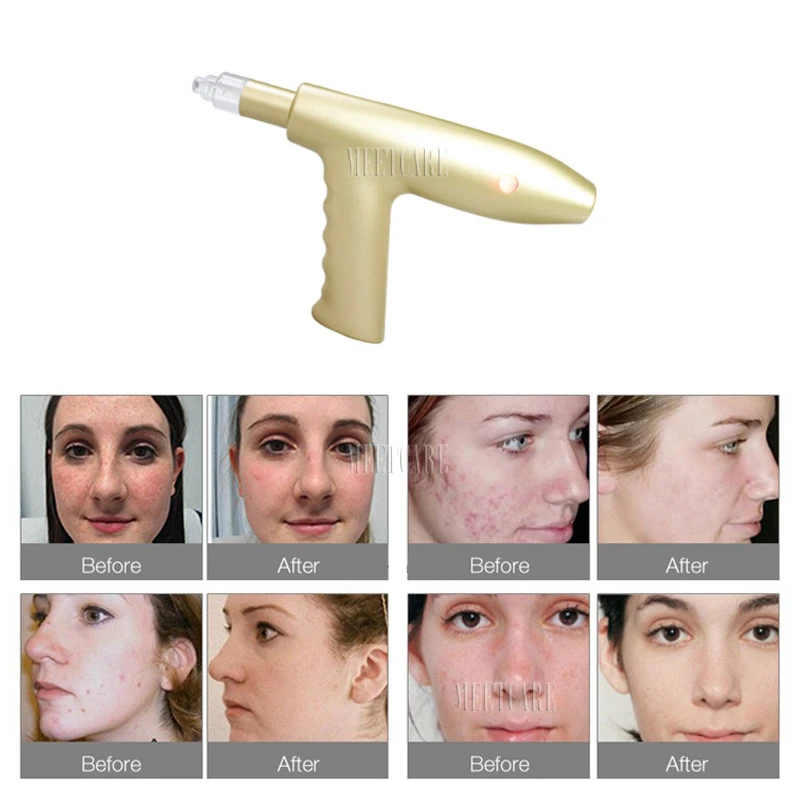 Nano Microneedle пистолет для инъекций воды красота машина уход за кожей лица