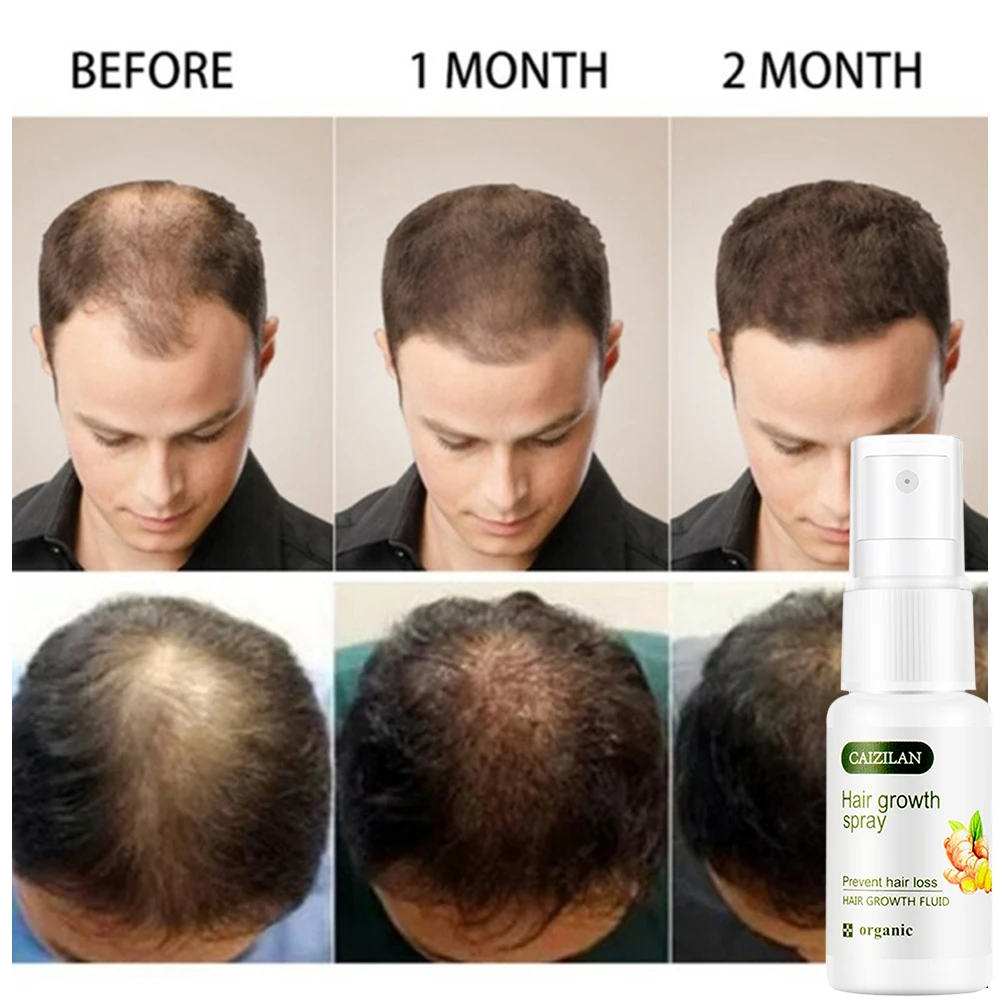 Натуральные волосы для роста эссенция против выпадения волос увеличение питания