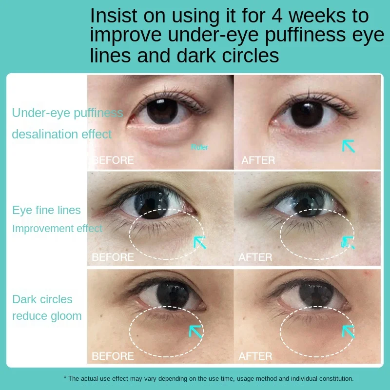 売る インテリジェントな目のための電気マッサージペン,目の下の治療,顔の足,健康のためのマッサージツール