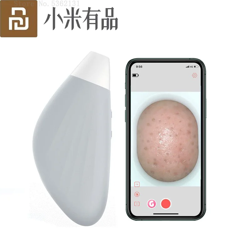 

Youpin Wireless Electric Visual Acne Remover Blackhead Vacuum Suction Facial Pore Cleaner Machine Skin Care with Nose patch