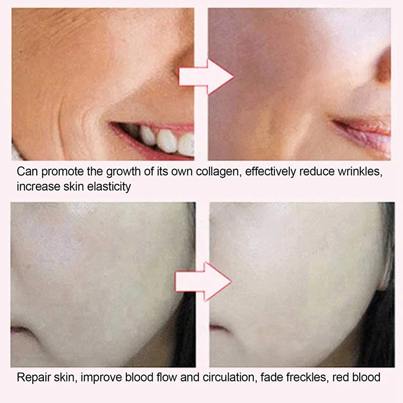

Household Facial Color Light 3D Silicone Massage Beauty Mask Face-Lifting Mask Instrument Led Spectrometer