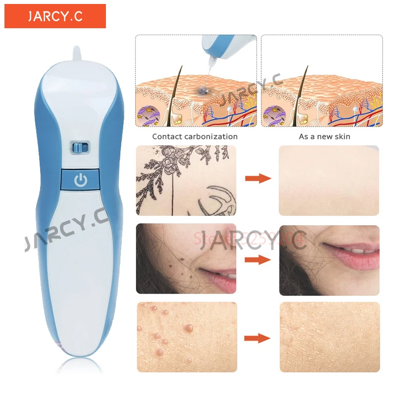 

Mole Freckle Removal Maglev Fibroblast Plasma Pen Eyelid Lifting Beauty Skin Care Machine Tattoo Dark Spot Skin Tag Remover Tool