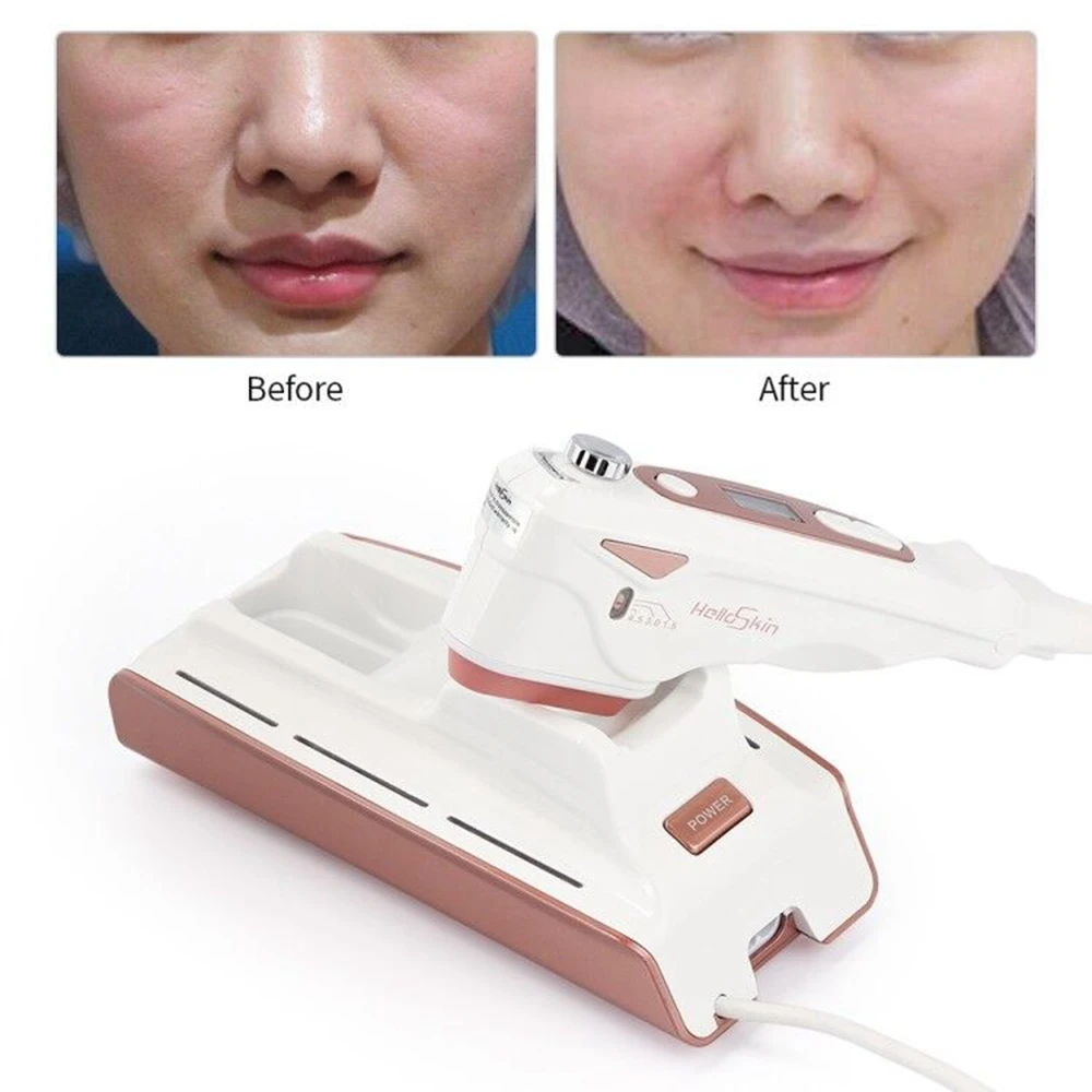 

MINI HIFU Multifunctional Skin Care Ultrasonic Facial Beauty Instrument Facial Lifting Rejuvenation Anti Aging Wrinkle Remove CE