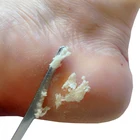 Многофункциональная Бритва для ногтей ног Набор ножей для педикюра пилка для удаления огрубевшей кожи ног инструменты для маникюра и педикюра
