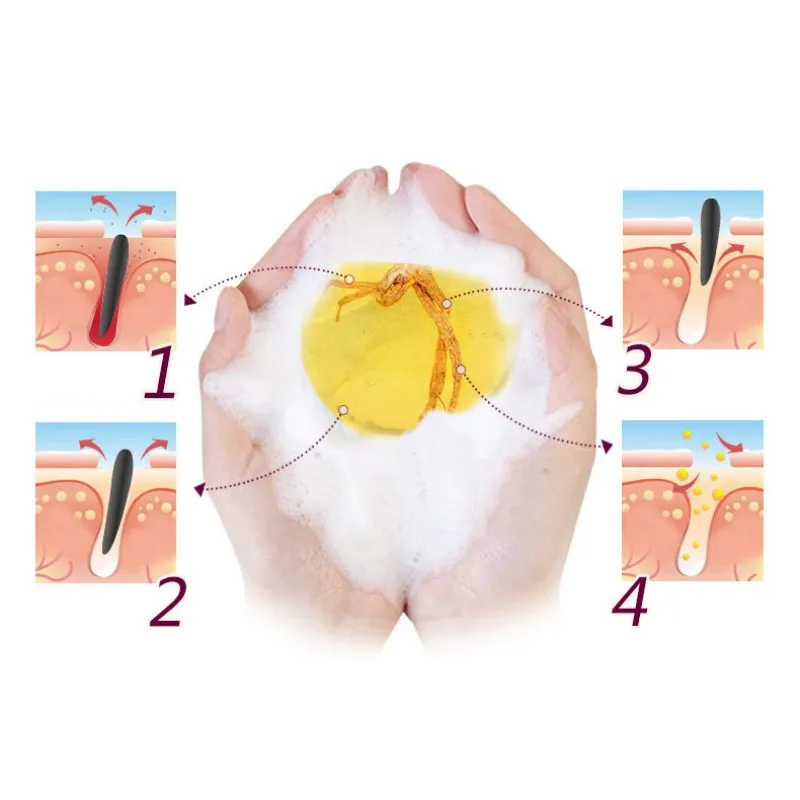 Мыло против грибка Отбеливающее питательное мыло подарочный набор цветы