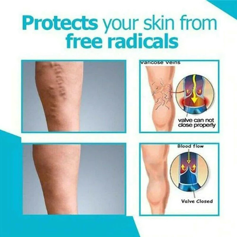 

2pcs Varicose Veins Miracle Cream Veins Relief Cream Pure Nature Ingredients Care J9