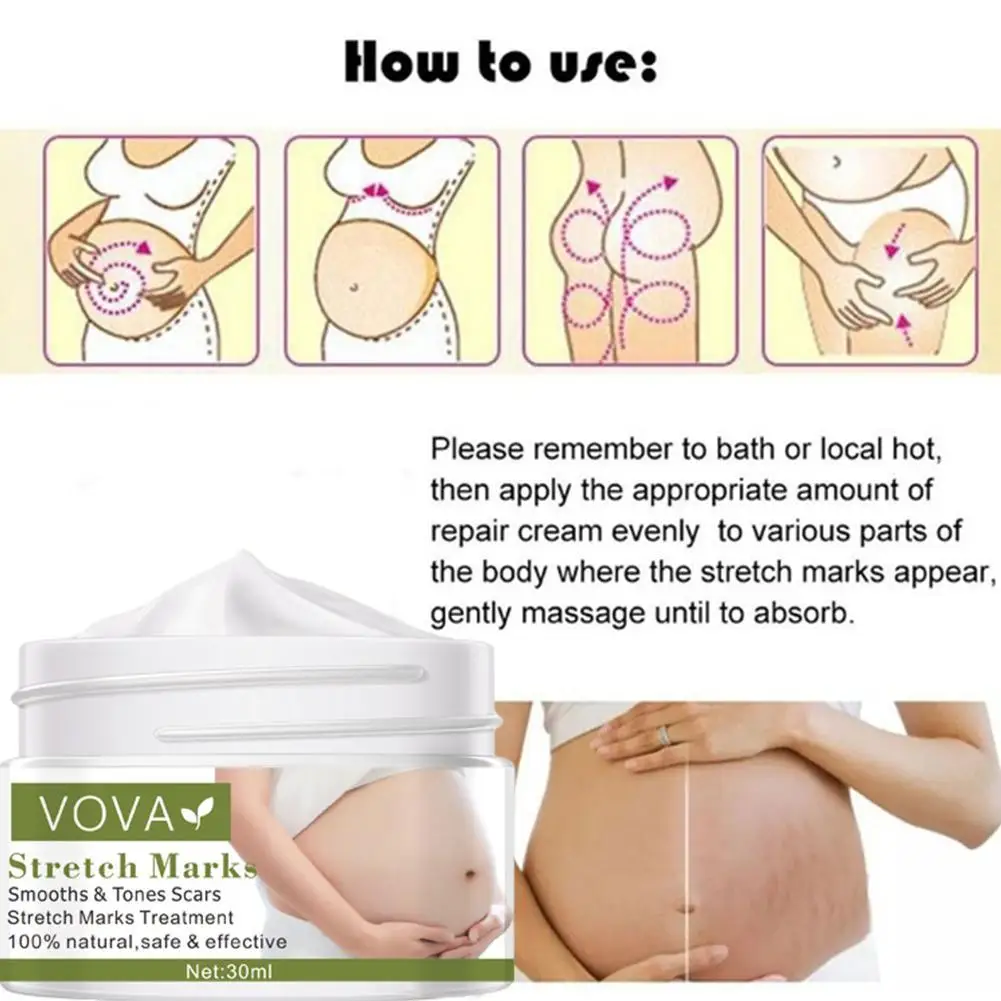 

Removes Stretch Mark Cream To Remove Postpartum Obesity Body Anti-Aging Repair Cream Firming Anti-Winkles Women Pregnant G8P1