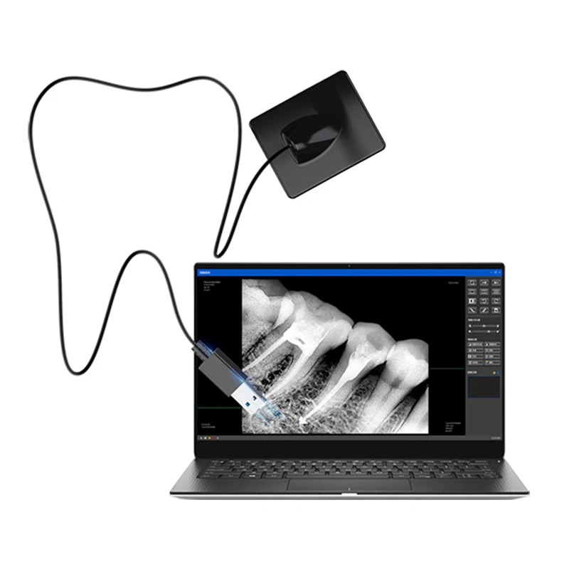 Портативный рентгеновский размагничиваемый usb-датчик rvg по заводской цене |