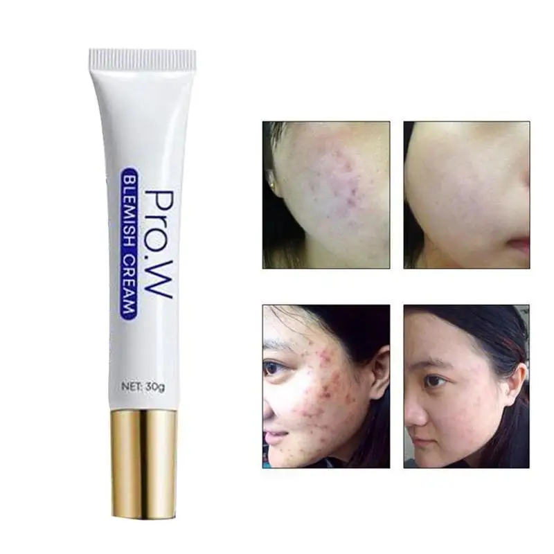 Extract Acne Scar Removal Cream Wounds Scars Stretch Treatment Marks K8D0
