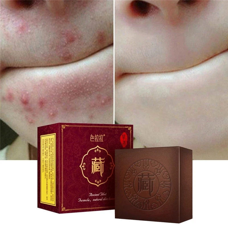 

Wash Face Soap Natural Non-irritating Oil Control Removal Blackhead Facial Anti Mites Tibetan Medicine Soap Cleansing Face Soap