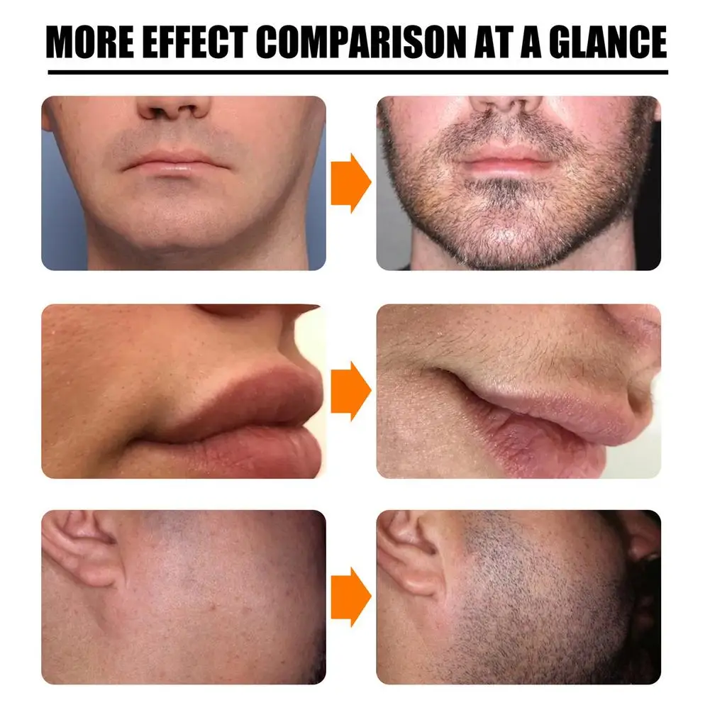 Жидкость для роста бороды мужчин рост стимулирует волос на лице восстанавливает