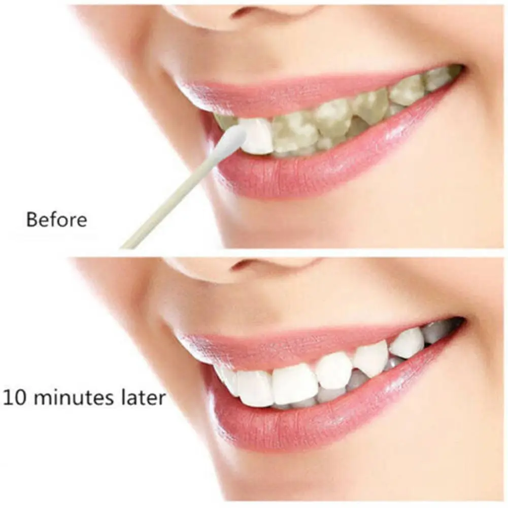 

Advanced Whitening Cleaning Tooth Care Kit Gel Bleaching White Professional Q1Z1