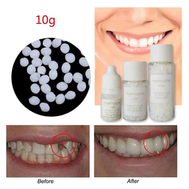 Рисунок 4 - Набор для временного ремонта зубных зазоров