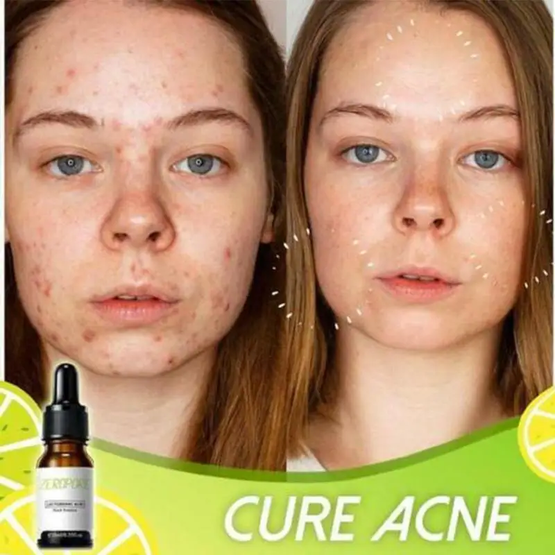 

Lactobionic Acid Face Serum Anti-Aging Wrinkles Essence Lift Fine Remove Anti-Oxidation Shrink Firming Exfoliating Lines Po D1N9
