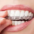 2 шт. пищевой силикон термоформа лоток для отбеливания зубов Уход за зубами Защита рта