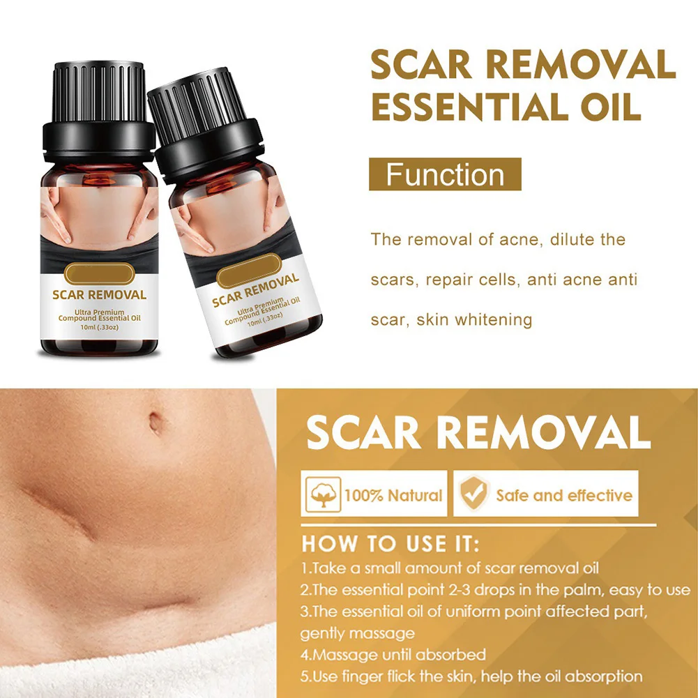 

Obesity Postpartum Marks Removal Stretch Marks Remover Essential Oils Pure Anti Repair Cream Skin Care