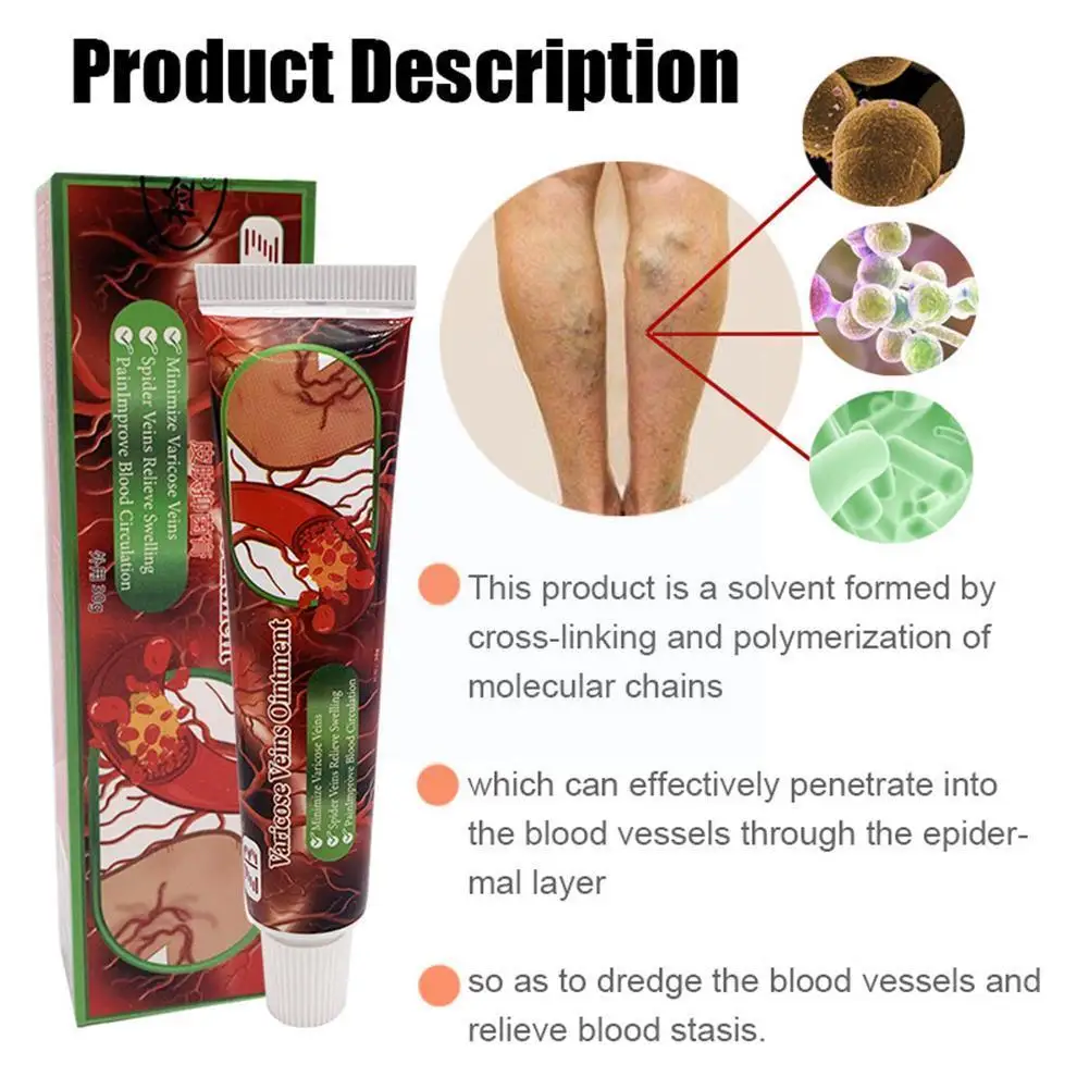 

20g Feet Varicose Veins Cream Treatment Dilated Capillaries Phlebitis Spider Relief Removal Leg Veins Ointment Pain Varicos fat