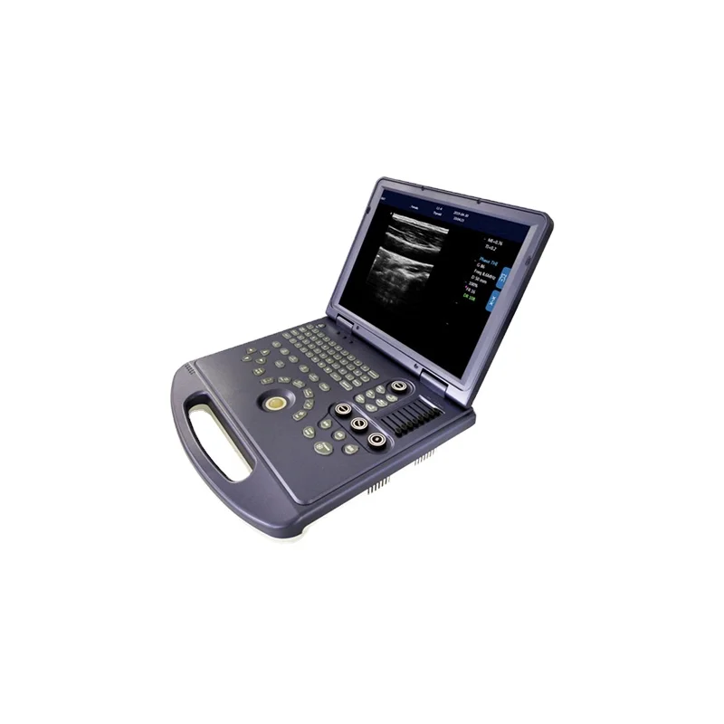 

Ce Approved Ultrasound Scanner Machine with 17 "LCD and High Brightness