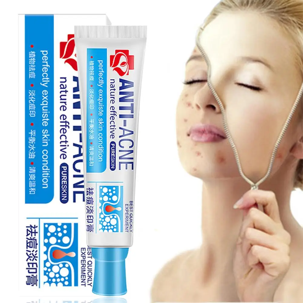 Средство для лечения шрамов от акне мужчин и женщин увлажняющий крем t жирной