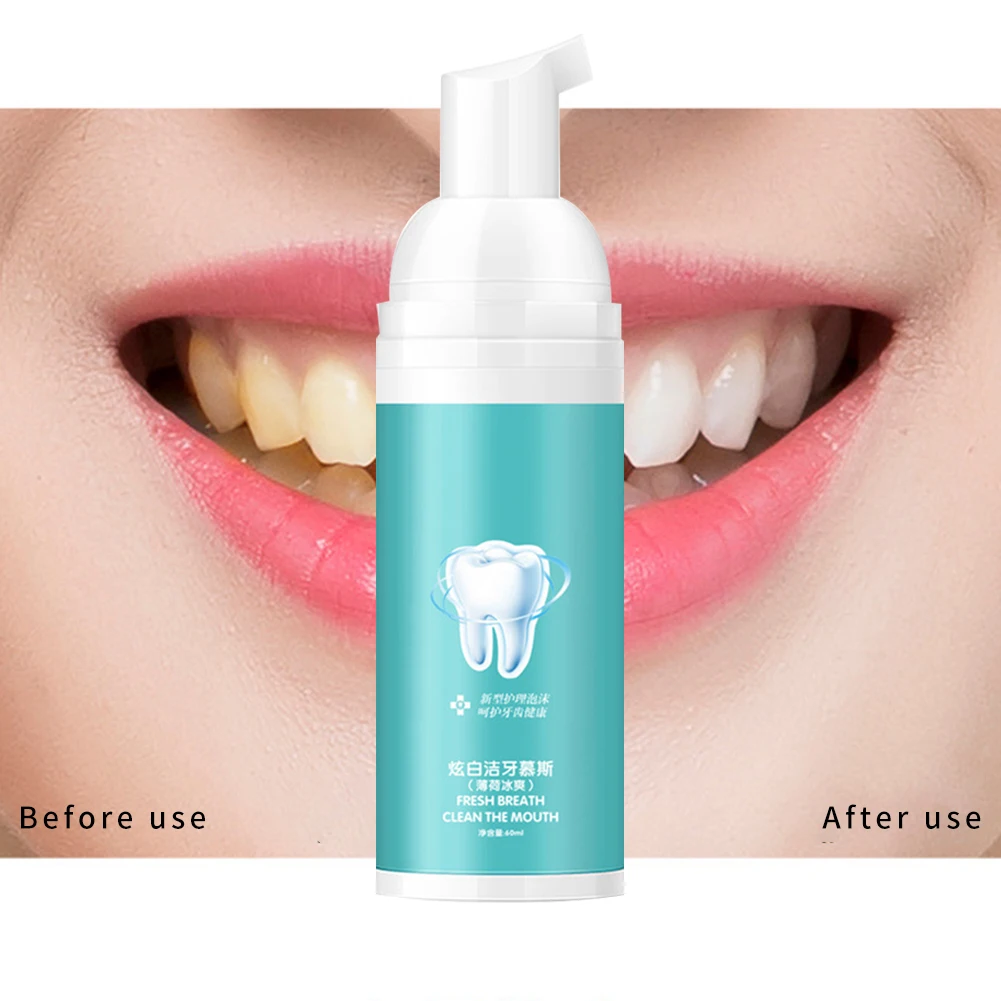 60 мл портативный дорожный Осветляющий мусс для чистки зубов зубной налет