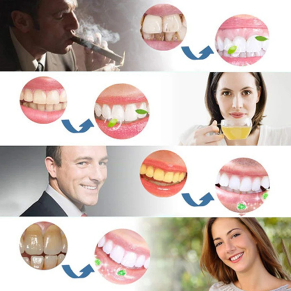 

28Pcs/14Pair Gel Teeth Whitening Strips White Tooth Dental Kit Oral Hygiene Care Strip For False Teeth Veneers Dentist Sets