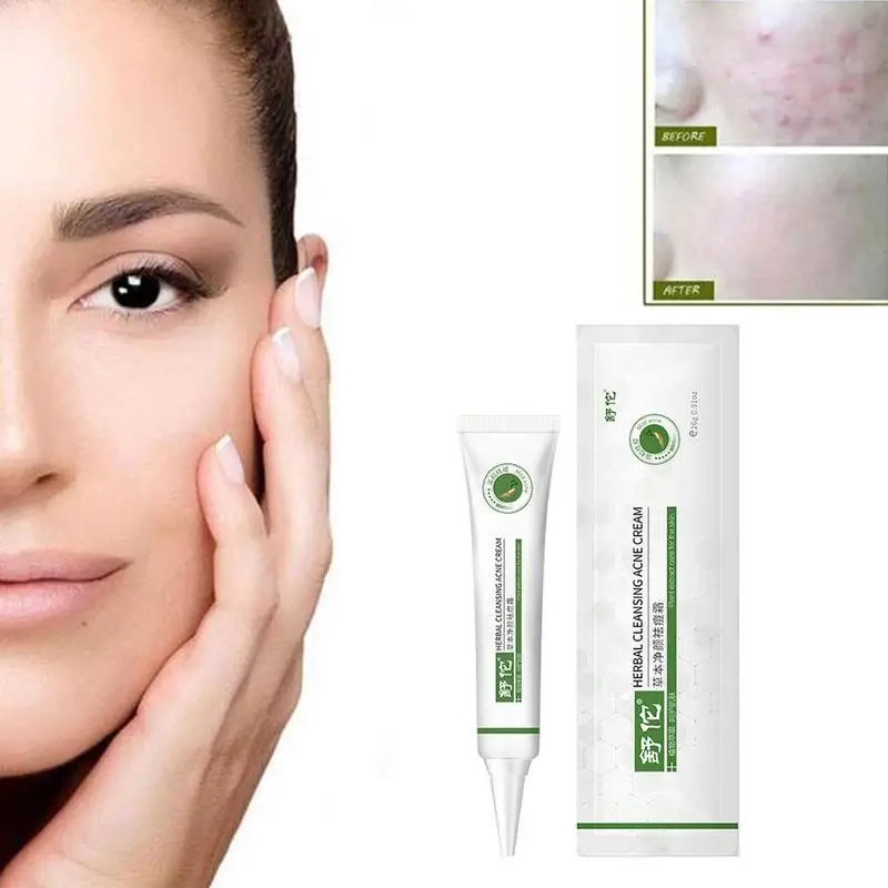26G Repair Cleansing Acne Cream Acne Anti Acne Treatment Whitening Scar Moisturizing Blackhead Cream G4X7