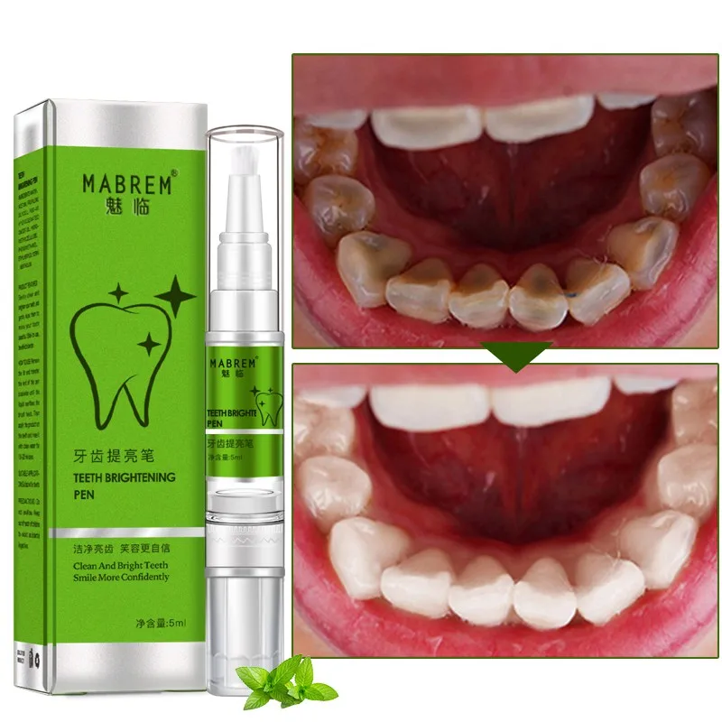 Magic Teeth Whitening Pen Removing Yellow Tooth Cleaning Dazzling White Smile | Красота и здоровье