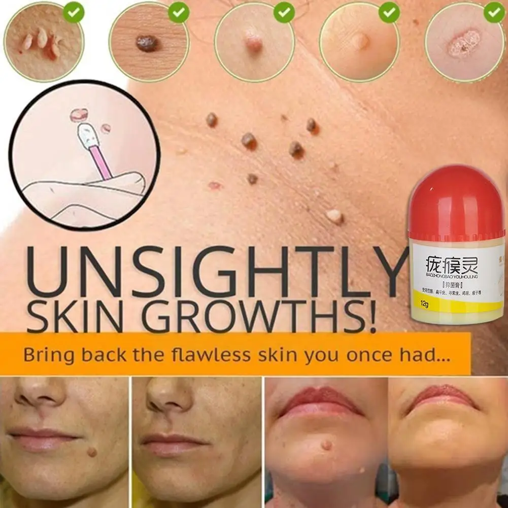 Пластырь искусственная кожа рельефный крем экстракт бородавок