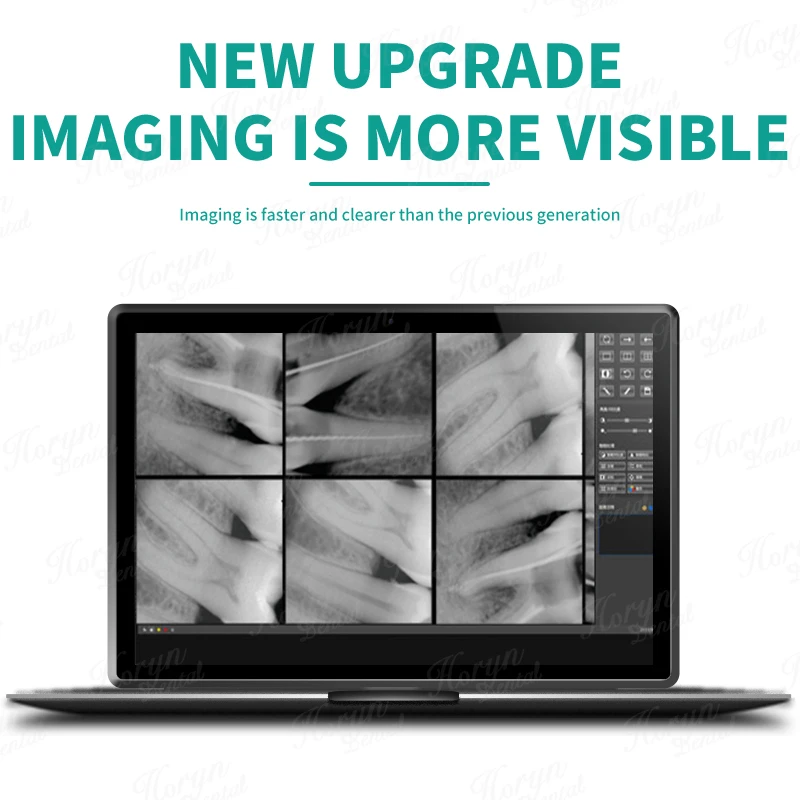 Рисунок 4 - Импортный корейский внутриоральный