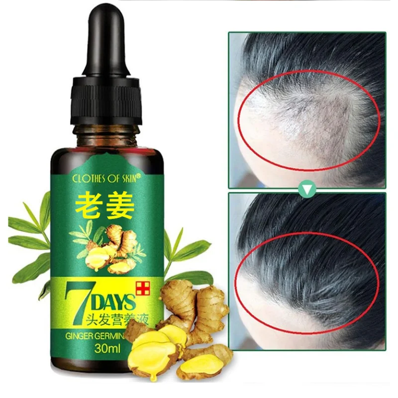 

30ml Ginger Germinal Oil Hair Nutrient Solution Hair Growth Essence Liquid Fast Hair Natural Hair Loss Treatment Hair Care