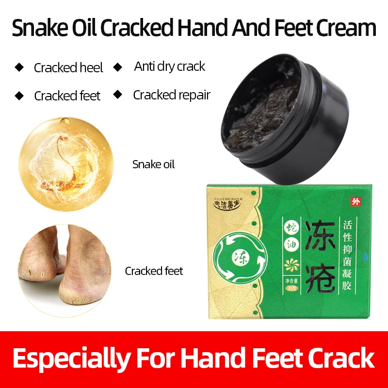 

Антифриз 30 г, змеиное масло, травяное лечение кожи рук и ног, сухая потресканная пятка, пилинг, пластырь для ухода