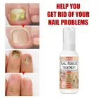Эссенция для восстановления ногтей EELHOE сыворотка-спрей лечение грибковых ногтей Удаление онихомикоза пальцы питающее Масло для кутикулы Уход за ногами TSLM1