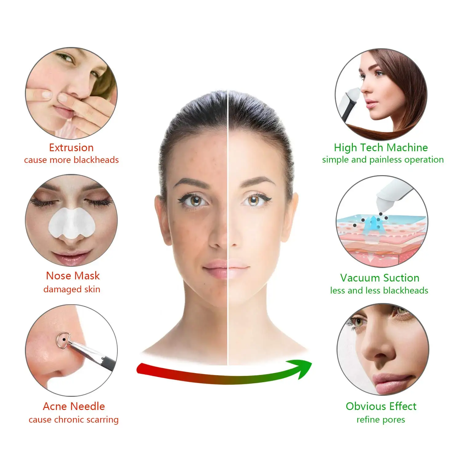 

Blackhead Remover with Camera WiFi Visual Pore Vacuum Electric Facial Pore Cleaner Extractor Tool Comedo Rechargeable Removal