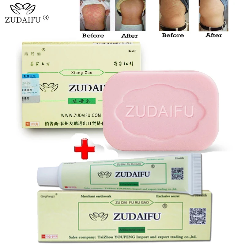 

5 шт. оригинальный крем для тела ZUDAIFU при псориазе + 1 шт. серное мыло Zudaifu