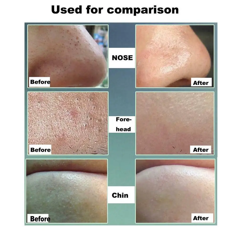 Маска для лица черные топы с басами 15 |