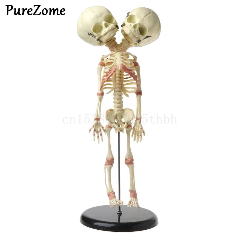 

37cm Human Double Head Baby Skull Skeleton Anatomy Brain Display Study Teaching Anatomical Model