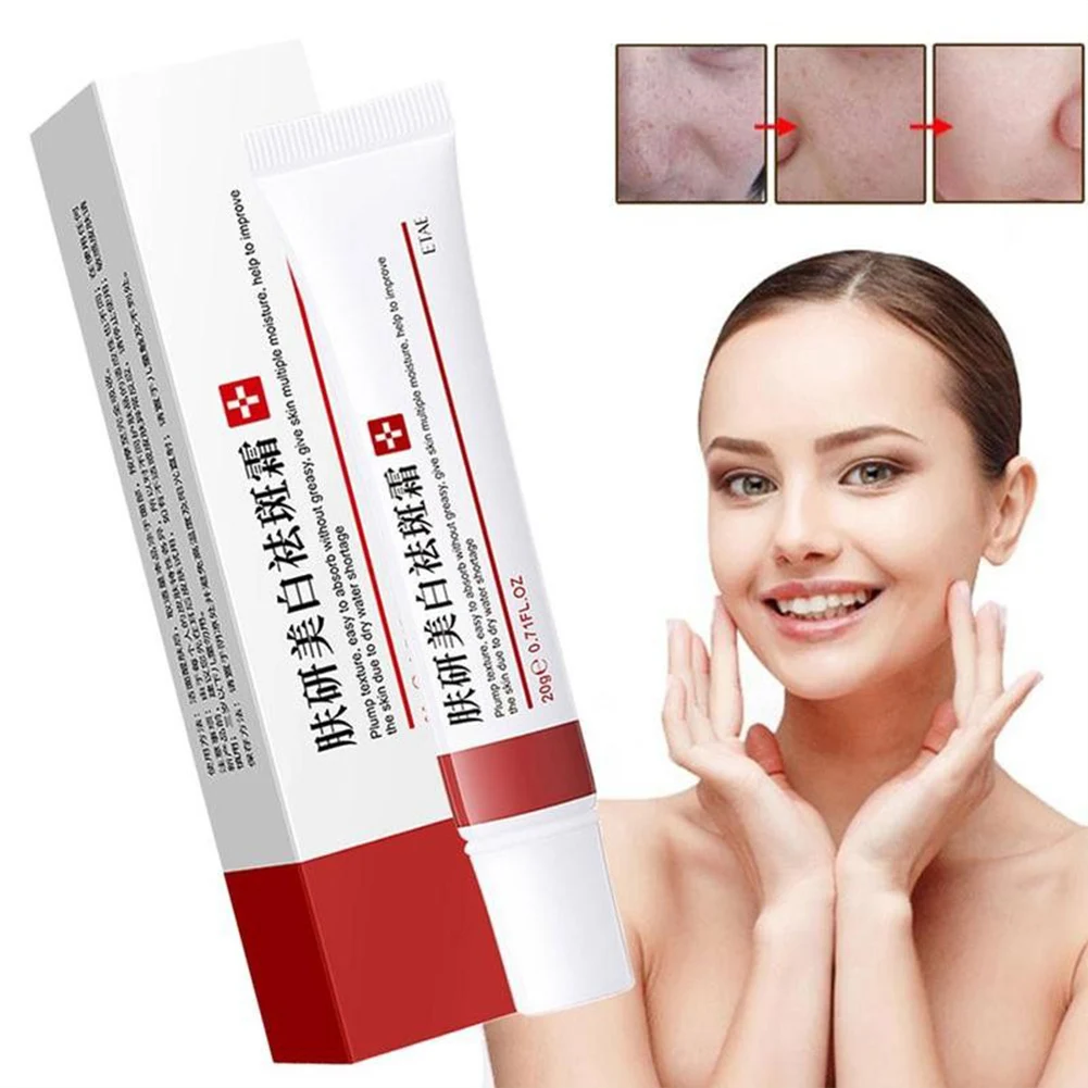 

Whitening Freckle Cream Remove Melasma Cream Remove Dark Spots Melanin Melasma Remover Brighten Skin Anti-Aging Skin Lightening