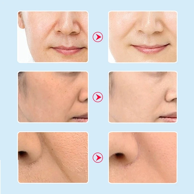 1 шт. маска для лица со змеиным ядом и пептидом | Красота здоровье